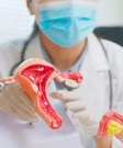 Ovarian